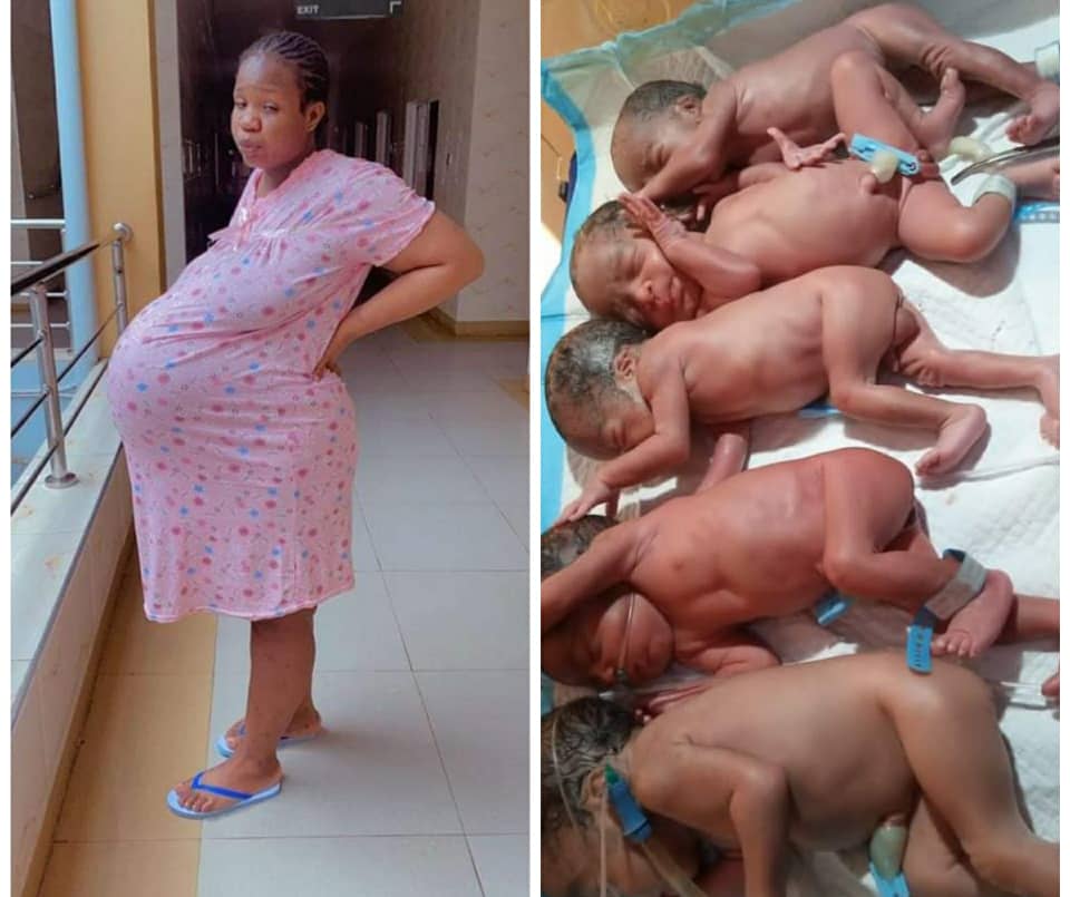 Woman gives birth to quintuplet after nine years of childless marriage