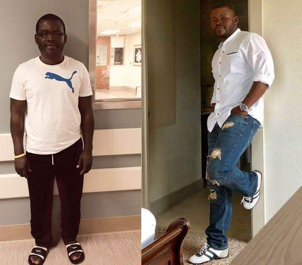 Man Undergoes Height Lengthening Surgery To Grow Taller 1 FB IMG 1681411148574