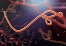 Nigeria’s Ebola patient is Swiss