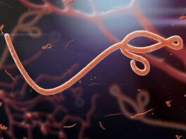 Nigeria’s Ebola patient is Swiss