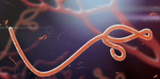 Nigeria’s Ebola patient is Swiss